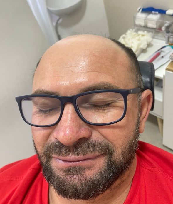Caso 3 - Renato - antes
